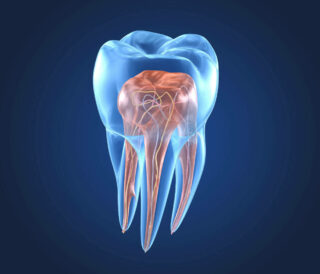 Endodontics